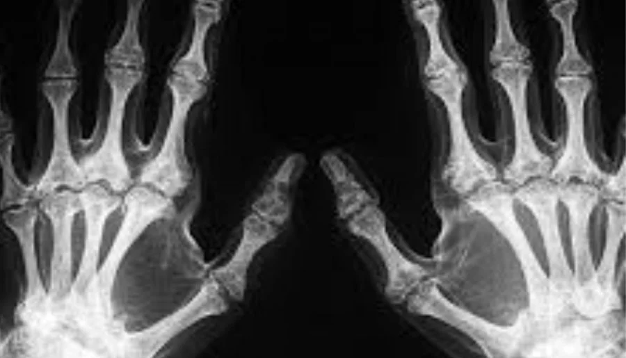 scientists discover ‘acquired habit’ that may explain human handedness puzzle